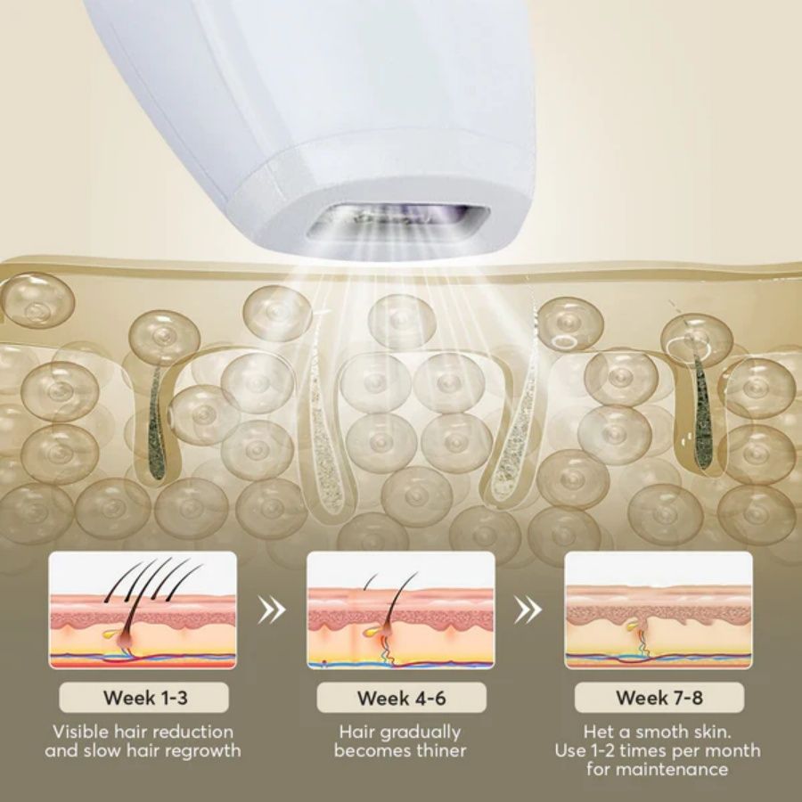 IPL Laser Hair Removal Device - 900,000 Flashes for Smooth Skin on Legs, Arms, and Bikini Line